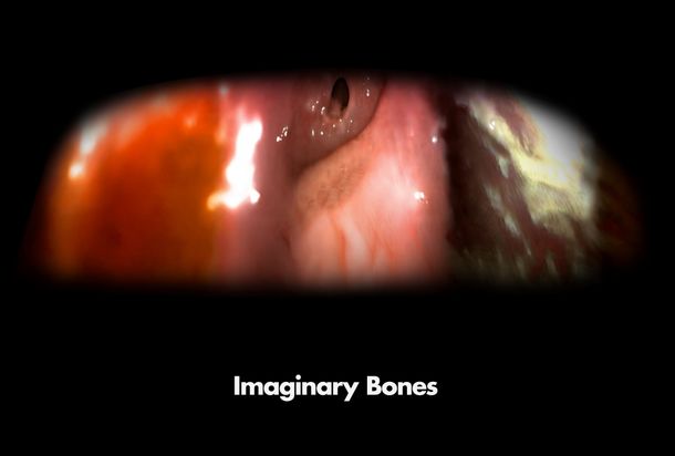 Imaginary Bones